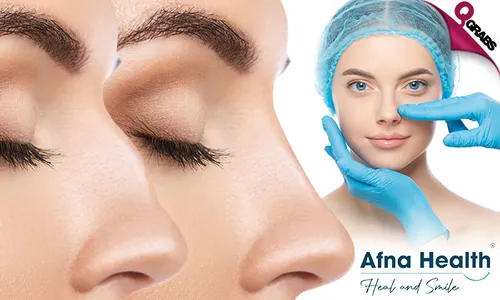 Rhinoplasty with 7 Days 5-Star Hotel Accommodation, Breakfast, VIP Hotel Transfer & Local Transfers in Turkey!